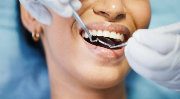 Best Emergency Dental Care for Abscessed Tooth in Clearlake Oaks, CA